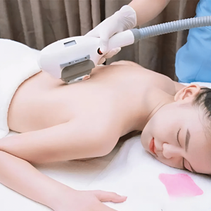 Triệt Lông Toàn Bộ Lưng & Gáy 10 Buổi - 40 Phút